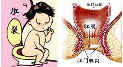 泉州看肠胃哪家医院好